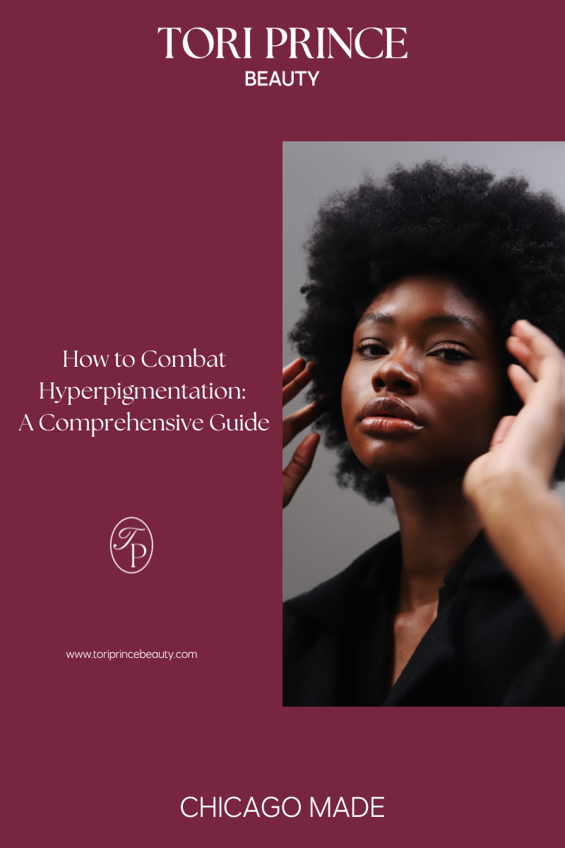 How to combat hyperpigmentation like a pro